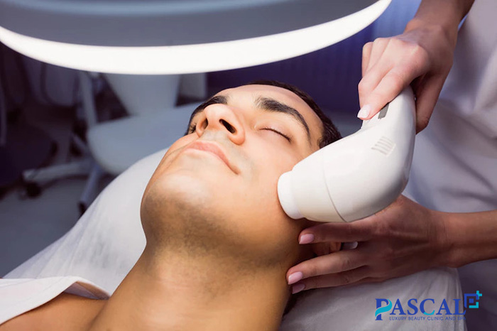 Cách trị nám da mặt cho nam bằng công nghệ laser