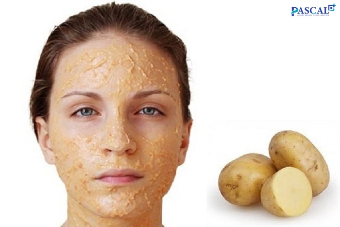 Cách trị nám với khoai tây giúp nuôi dưỡng làn da từ sâu bên trong