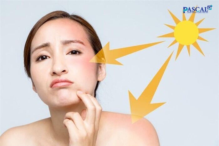 Trẻ hóa da cổ cần chống nắng tránh những tác động của tia UV từ ánh nắng 