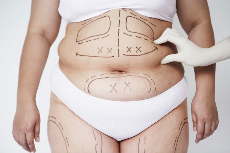 Để đảm bảo cân nặng chuẩn của nữ còn cần chú ý đến tỷ lệ mỡ trong cơ thể 