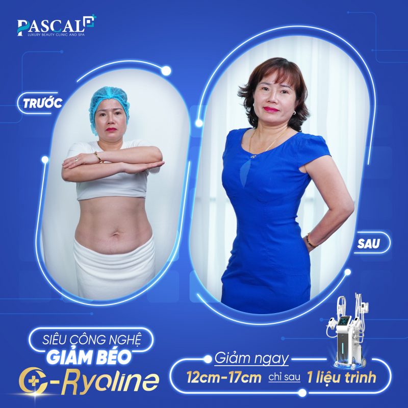 C-Ryoline giảm béo thành công cho rất nhiều khách hàng 