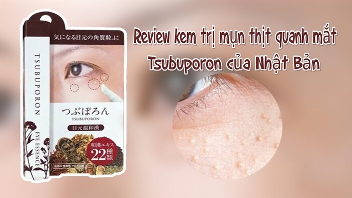 Kem trị mụn thịt Nhật Bản Tsubuporon không chỉ điều trị mụn thịt mà còn giúp dưỡng ẩm quanh mắt 
