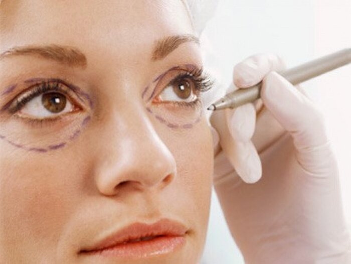 Trẻ hóa vùng mắt là tổng hợp những phương pháp giúp làm trẻ hóa da mắt hiệu quả 